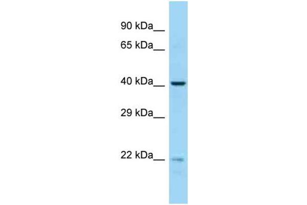 anti-Essential Meiotic Endonuclease 1 Homolog 2 (EME2) (Middle Region) antibody