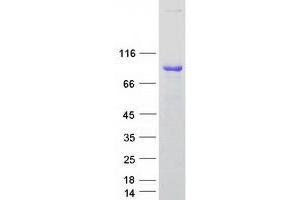 Image no. 1 for rho Guanine Nucleotide Exchange Factor (GEF) 7 (ARHGEF7) (Transcript Variant 5) protein (Myc-DYKDDDDK Tag) (ABIN2714895)