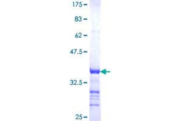 RUNX3 Protein (Runt-Related Transcription Factor 3) (AA 194-279) (GST tag)