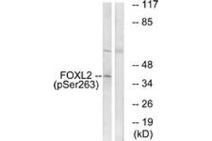Image no. 1 for anti-Forkhead Box L2 (FOXL2) (AA 229-278), (pSer263) antibody (ABIN1531739)