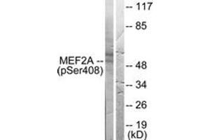 Western blot analysis of extracts from HeLa cells treated with PMA 125ng/ml 30', using MEF2A (Phospho-Ser408) Antibody.