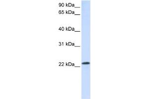 Image no. 1 for anti-RAB18, Member RAS Oncogene Family (RAB18) (C-Term) antibody (ABIN2777760)
