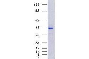 Image no. 1 for Cytochrome P450, Family 4, Subfamily F, Polypeptide 12 (CYP4F12) protein (Myc-DYKDDDDK Tag) (ABIN2712781)