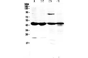 anti-Adenosine Deaminase (ADA) (AA 2-241) antibody
