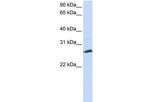 anti-Synaptonemal Complex Protein 3 (SYCP3) (N-Term) antibody