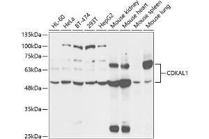 CDKAL1 Antikörper  (AA 1-230)