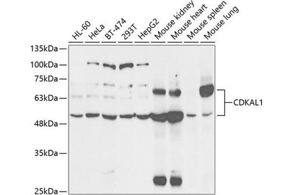 CDKAL1 anticorps  (AA 1-230)