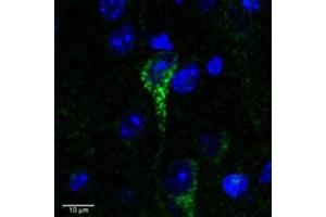 Image no. 4 for anti-Corticotropin Releasing Hormone Receptor 1 (CRHR1) (AA 107-117) antibody (ABIN238557)