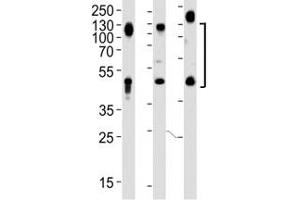Image no. 4 for anti-Lysosomal-Associated Membrane Protein 1 (LAMP1) (AA 125-154) antibody (ABIN3031663)