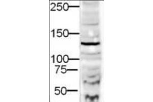 Western blot using  Affinity Purified anti-DIA-2 antibody shows detection of a 132-kDa band corresponding to DIA-2 in a lysate prepared from human derived HEK293 cells.
