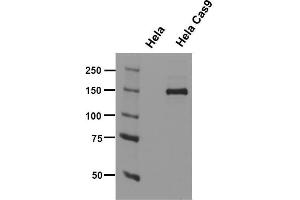 Western Blotting (WB) image for anti-CRISPR-Cas9 antibody (ABIN5563965)