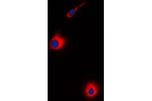 Image no. 2 for anti-Ubiquitin Specific Peptidase 30 (Usp30) (N-Term) antibody (ABIN2707779)