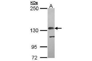 Image no. 3 for anti-Complement Factor H (CFH) (Internal Region) antibody (ABIN2854706)