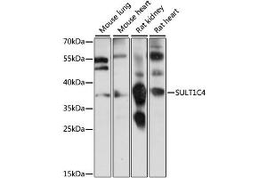 Image no. 1 for anti-Sulfotransferase Family, Cytosolic, 1C, Member 4 (SULT1C4) antibody (ABIN6293706)