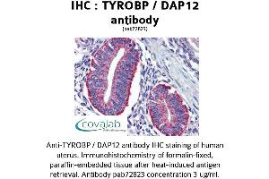 Image no. 2 for anti-TYRO Protein tyrosine Kinase Binding Protein (TYROBP) (Internal Region) antibody (ABIN1740506)