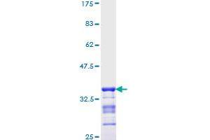 Image no. 1 for NK2 Homeobox 1 (NKX2-1) (AA 56-147) protein (GST tag) (ABIN1312621)