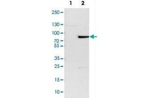 Image no. 3 for anti-Zinc Finger and BTB Domain Containing 7B (ZBTB7B) antibody (ABIN5591156)