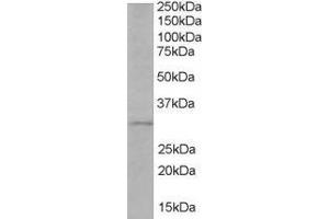 Image no. 1 for anti-Toll-Interleukin 1 Receptor (TIR) Domain Containing Adaptor Protein (TIRAP) (C-Term) antibody (ABIN184633)