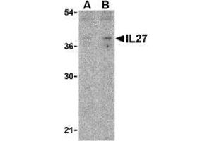 Image no. 2 for anti-Interleukin-27 Subunit alpha (IL27) (N-Term) antibody (ABIN500000)