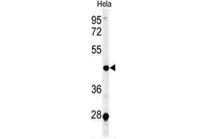 CHN2 antibody  (Middle Region)