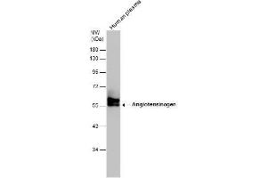 Image no. 3 for anti-Angiotensinogen (serpin Peptidase Inhibitor, Clade A, Member 8) (AGT) (Center) antibody (ABIN2855709)
