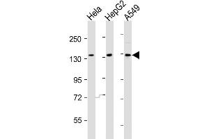 Image no. 1 for anti-Apoptosis-Associated tyrosine Kinase (AATK) (AA 46-74), (N-Term) antibody (ABIN5536368)