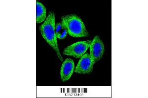 Image no. 3 for anti-Adiponectin Receptor 2 (ADIPOR2) (AA 45-72) antibody (ABIN651298)