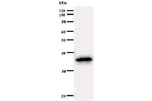 Image no. 1 for anti-Sex Comb On Midleg-Like 2 (SCML2) antibody (ABIN933093)