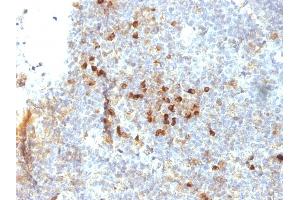 Image no. 3 for anti-HLA Class II DR alpha (HLA-DRA) antibody (ABIN6939638)