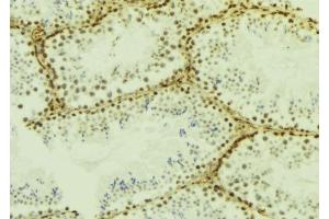 Image no. 3 for anti-Interferon Induced with Helicase C Domain 1 (IFIH1) antibody (ABIN6262453)
