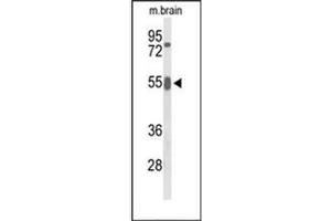 Image no. 1 for anti-Growth Factor Receptor-Bound Protein 7 (GRB7) (AA 297-326), (Middle Region) antibody (ABIN952626)