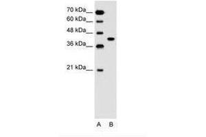 Image no. 1 for anti-Solute Carrier Family 35, Member B1 (SLC35B1) (AA 288-337) antibody (ABIN205013)