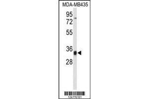 Image no. 1 for anti-TCF3 (E2A) Fusion Partner (In Childhood Leukemia) (TFPT) (AA 60-88), (N-Term) antibody (ABIN653252)