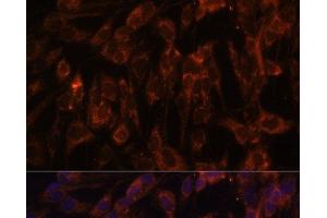 Immunofluorescence analysis of C6 cells using TLR3 Polyclonal Antibody at dilution of 1:100.