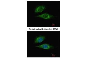 ICC/IF Image Immunofluorescence analysis of methanol-fixed HeLa, using ESE1, antibody at 1:500 dilution.
