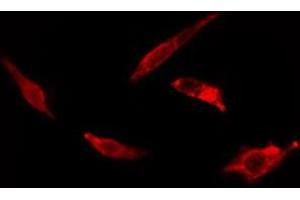 Image no. 1 for anti-Eukaryotic Translation Elongation Factor 1 gamma (EEF1G) antibody (ABIN6259631)