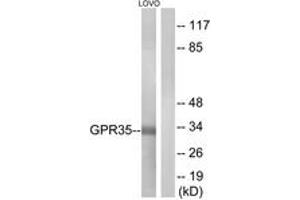 Image no. 1 for anti-G Protein-Coupled Receptor 35 (GPR35) (AA 51-100) antibody (ABIN1535744)