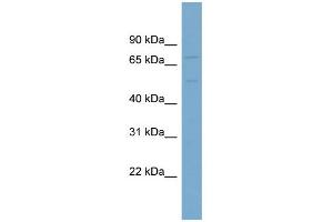 Image no. 1 for anti-Solute Carrier Family 7 (Cationic Amino Acid Transporter, Y+ System), Member 1 (SLC7A1) (N-Term) antibody (ABIN2773832)