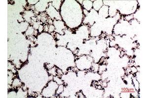 Image no. 2 for anti-Selectin L (SELL) (Internal Region) antibody (ABIN3187678)
