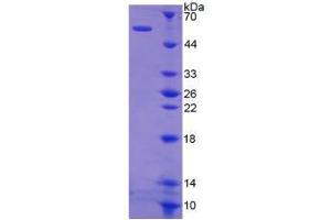 Image no. 1 for Kallikrein 1 (KLK1) (AA 27-261) protein (His tag,GST tag) (ABIN6237702)