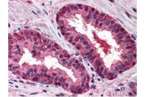 Anti-CUL2 antibody was diluted 1:500 to detect CUL2 in human prostate tissue.
