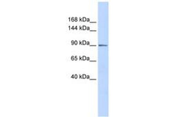 PHF16 Antikörper  (AA 359-408)
