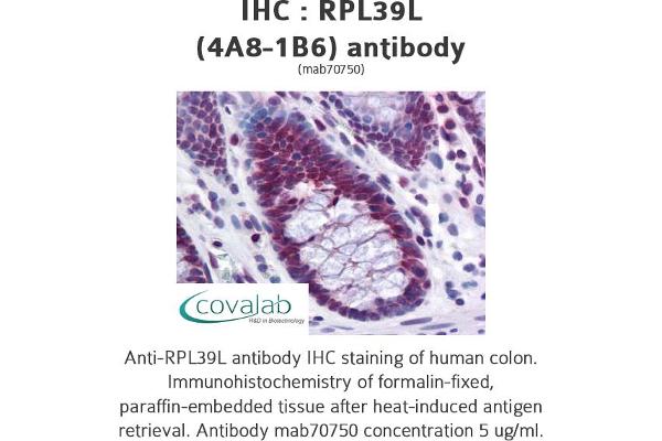 RPL39L Antikörper  (full length)
