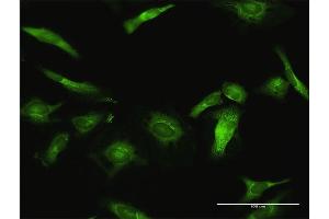 Immunofluorescence of purified MaxPab antibody to USP10 on HeLa cell.