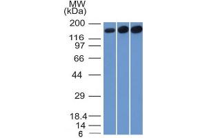 anti-Topoisomerase (DNA) II alpha 170kDa (TOP2A) (AA 1352-1493) antibody