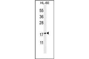 Image no. 3 for anti-Phospholipase A2, Group IID (PLA2G2D) (AA 112-138), (C-Term) antibody (ABIN954162)