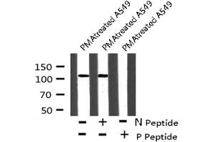 Image no. 5 for anti-Fms-Related tyrosine Kinase 3 (FLT3) (pTyr591) antibody (ABIN6271470)