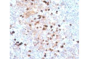 Immunohistochemistry (IHC) image for Mouse anti-Human IgM Heavy Chain antibody (ABIN3026664)