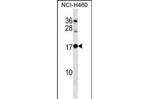 Image no. 1 for anti-Ribosomal Protein L12 (RPL12) (AA 71-100) antibody (ABIN5535369)