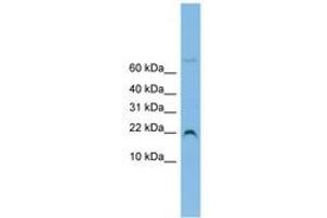 Image no. 1 for anti-NHP2 Non-Histone Chromosome Protein 2-Like 1 (NHP2L1) (N-Term) antibody (ABIN6744689)